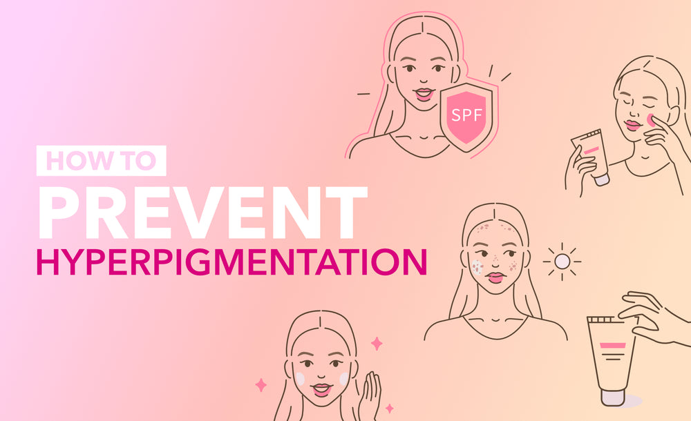 How to Prevent Hyperpigmentation
