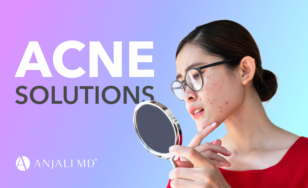 How to Combat Acne: Tips for Clearer Skin